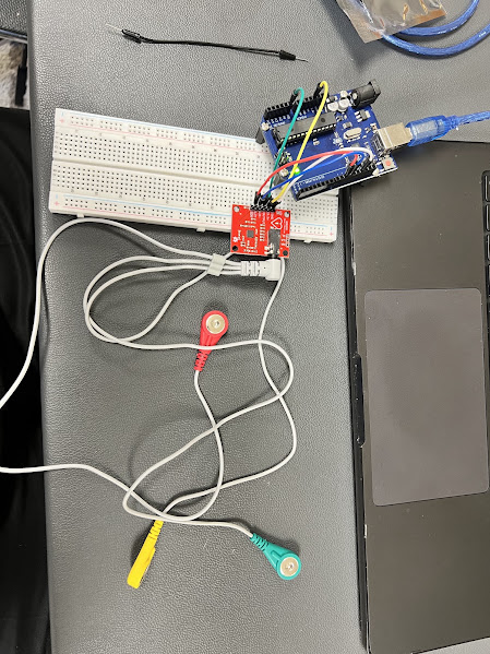 Arduino ECG Project